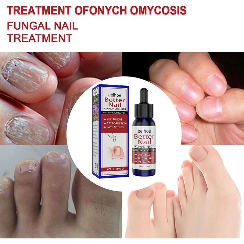 Toenail Fungus Treatment Liquid