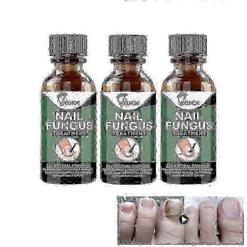 EELHOE Nail Repair Liquid Gray Nail Liquid Uneven Thick Nail Thickening Gray Nail Soft Nail Hand and Foot Repair Liquid