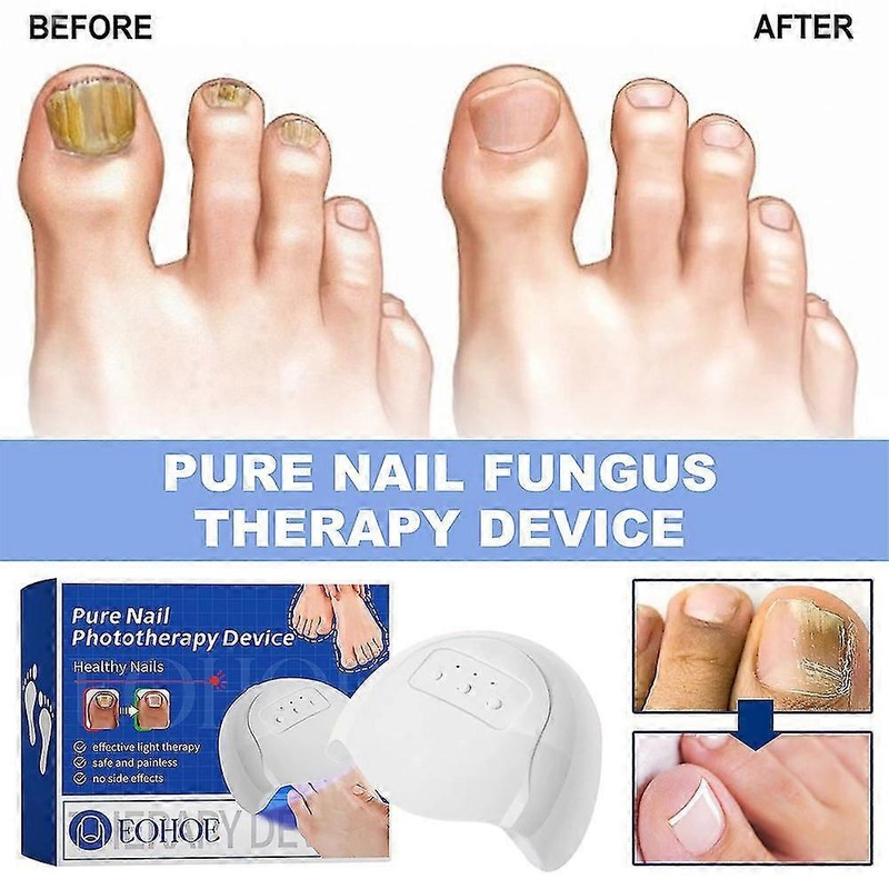 Purenail Fungus Laser Device, Light Therapy Device Fungal Nail Onychomycosis Toes Treatment, Nail Care