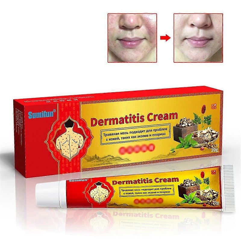 1/2pcs Eczema Dermatitis Psoriasis Cream Skin Care Ointment Treatment Anti-itching Bacteriostasis