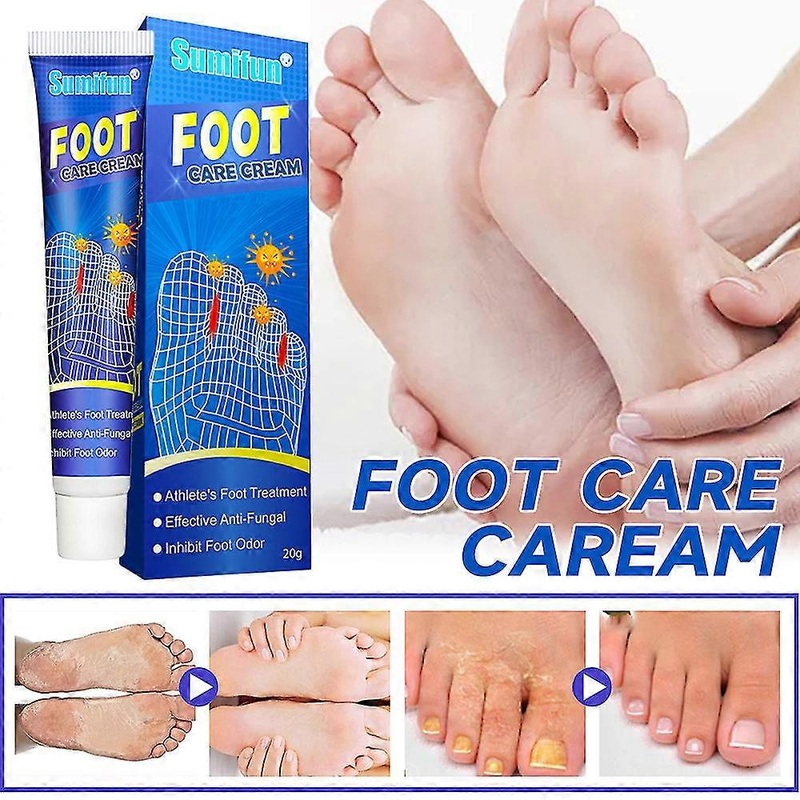 1/2Pcs Beriberi Treat Athlete's Feet Ointment Foot Itching Anti-Fungal Treatment Foot Care