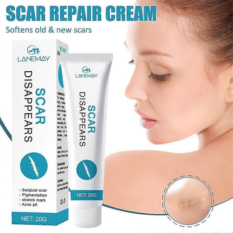 1/2Pcs Acne Removal Cream Pimple Pits Pustule Deep Cleaning Face Repair Skin